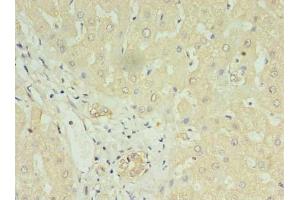 Immunohistochemistry of paraffin-embedded human liver tissue using ABIN7158666 at dilution of 1:100 (LYRM1 anticorps  (AA 1-122))