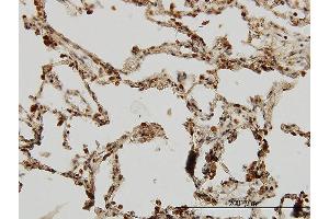 Immunoperoxidase of monoclonal antibody to IRAK1 on formalin-fixed paraffin-embedded human lung.