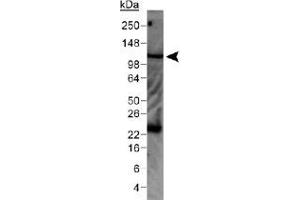 Western blot analysis of WNK4 in mouse kidney lysate with WNK4 polyclonal antibody . (WNK4 anticorps  (AA 200-300))