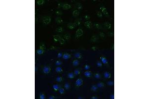 Immunofluorescence analysis of C6 cells using COPG2 Polyclonal Antibody (ABIN7266425) at dilution of 1:100 (40x lens). (COPG2 anticorps  (AA 542-871))
