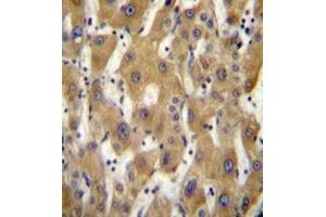 Immunohistochemistry analysis in formalin fixed and paraffin embedded human liver tissue reacted with PAGE5 Antibody (C-term) followed which was peroxidase conjugated to the secondary antibody and followed by DAB staining. (PAGE5 anticorps  (C-Term))