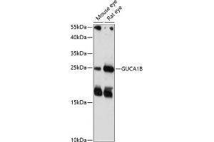 Western blot analysis of extracts of various cell lines, using GUCB antibody (4739) at 1:1000 dilution. (GUCA1B anticorps  (AA 1-200))