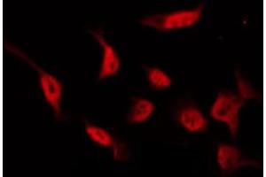 ABIN6274548 staining COLO by IF/ICC. (CDK11 anticorps  (Internal Region))