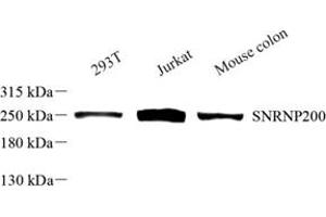 Western blot analysis of SNRNP200 (ABIN7075632) at dilution of 1: 500 (SNRNP200 anticorps)