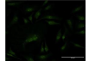 Immunofluorescence of monoclonal antibody to PMS2 on HeLa cell. (PMS2 anticorps  (AA 763-862))