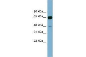 Image no. 1 for anti-Zinc Finger Protein 169 (ZNF169) (AA 71-120) antibody (ABIN6742078)