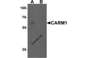 Western Blotting (WB) image for anti-Coactivator-Associated Arginine Methyltransferase 1 (CARM1) (N-Term) antibody (ABIN1077435) (CARM1 anticorps  (N-Term))