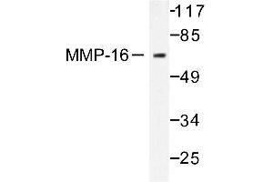 Image no. 1 for anti-Matrix Metallopeptidase 16 (Membrane-inserted) (MMP16) antibody (ABIN265527)