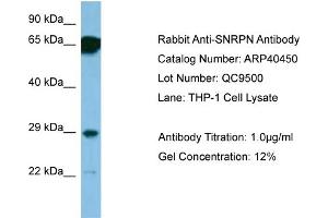 WB Suggested Anti-SNRPN Antibody   Titration: 1. (SNRPN anticorps  (N-Term))