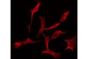 ABIN6274609 staining NIH-3T3 by IF/ICC. (CADM3 anticorps  (Internal Region))