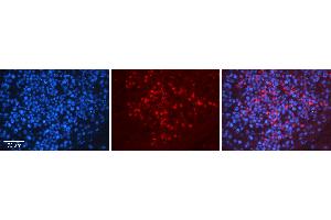 Rabbit Anti-HNRNPU Antibody   Formalin Fixed Paraffin Embedded Tissue: Human Testis Tissue Observed Staining: Cytoplasm and nucleus in spermatogonia and spermatocytes Primary Antibody Concentration: N/A Other Working Concentrations: 1:600 Secondary Antibody: Donkey anti-Rabbit-Cy3 Secondary Antibody Concentration: 1:200 Magnification: 20X Exposure Time: 0.