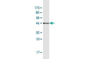 Western Blot detection against Immunogen (45.