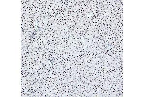 IHC analysis of PTBP2 using anti-PTBP2 antibody (ABIN7599452). (PTBP2 anticorps  (AA 1-504))