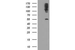Western Blotting (WB) image for anti-Lipase, Endothelial (LIPG) antibody (ABIN1499173) (LIPG anticorps)
