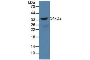 Western blot analysis of recombinant Rat SOX18. (SOX18 anticorps  (AA 153-377))