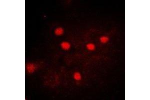 Immunofluorescent analysis of USP26 staining in A549 cells. (USP26 anticorps)