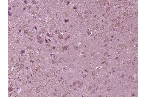 Paraformaldehyde-fixed, paraffin embedded mouse brain; Antigen retrieval by boiling in sodium citrate buffer (pH6) for 15min; Block endogenous peroxidase by 3% hydrogen peroxide for 30 minutes; Blocking buffer (normal goat serum) at 37°C for 20min; Antibody incubation with KIF7 Polyclonal Antibody, Unconjugated (bs-12388R)at 1:200 overnight at 4°C, followed by a conjugated secondary and DAB staining.