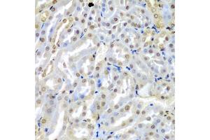 Immunohistochemistry of paraffin-embedded mouse kidney using TUSC2 antibody (ABIN5974256) at dilution of 1/200 (40x lens).