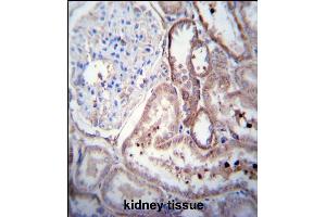 SCDGFB Antibody (Center) (ABIN390196 and ABIN2840684) immunohistochemistry analysis in formalin fixed and paraffin embedded human kidney tissue followed by peroxidase conjugation of the secondary antibody and DAB staining. (PDGFD anticorps  (AA 313-341))