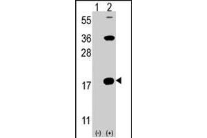 Western blot analysis of CD247 (arrow) using rabbit CD247 polyclonal antibody . (CD247 anticorps  (C-Term))