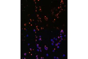 Immunofluorescence analysis of Jurkat cells using CD27 antibody (ABIN3022680, ABIN3022681, ABIN3022682 and ABIN6219092) at dilution of 1:100. (CD27 anticorps  (AA 20-191))