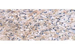Immunohistochemistry of paraffin-embedded Human brain tissue using CEP89 Polyclonal Antibody at dilution of 1:95(x200) (CEP89 anticorps)