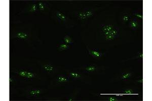 Immunofluorescence of purified MaxPab antibody to PNO1 on HeLa cell.
