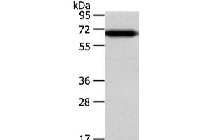 Western Blot analysis of Hepg2 cell using USP39 Polyclonal Antibody at dilution of 1/400 (USP39 anticorps)