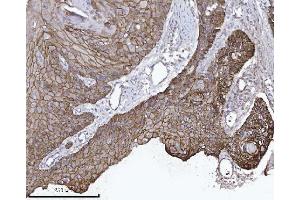 IHC analysis of CTNND1 using anti-CTNND1 antibody (ABIN7602220). (CTNND1 anticorps  (AA 64-930))