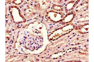 Immunohistochemistry of paraffin-embedded human kidney tissue using ABIN7143254 at dilution of 1:100 (Acylglycerol Kinase anticorps  (AA 32-65))