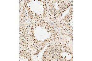 (ABIN6243447 and ABIN6578904) staining METTL14 in human testis tissue sections by Immunohistochemistry (IHC-P - paraformaldehyde-fixed, paraffin-embedded sections). (METTL14 anticorps  (AA 2-36))