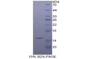 SDS-PAGE analysis of Human Inhibin beta A Protein. (INHBA Protéine)