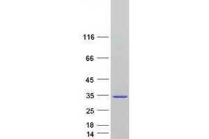 Validation with Western Blot
