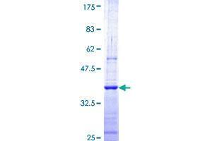 Image no. 1 for CCR4-NOT Transcription Complex, Subunit 7 (CNOT7) (AA 1-100) protein (GST tag) (ABIN1349868)