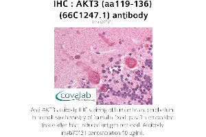Image no. 1 for anti-V-Akt Murine Thymoma Viral Oncogene Homolog 3 (Protein Kinase B, Gamma) (AKT3) (AA 119-136) antibody (ABIN1723080) (AKT3 anticorps  (AA 119-136))