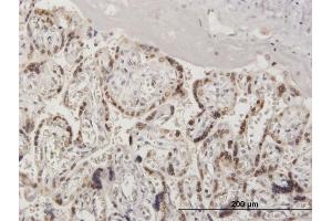 Immunoperoxidase of purified MaxPab antibody to RANGAP1 on formalin-fixed paraffin-embedded human placenta.