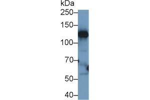 Western blot analysis of Human Liver lysate, using Human CP Antibody (1 µg/ml) and HRP-conjugated Goat Anti-Rabbit antibody ( (Ceruloplasmin anticorps  (AA 789-1065))