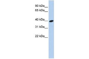 Western Blotting (WB) image for anti-ADP-Ribosylation Factor-Like 13B (ARL13B) antibody (ABIN2459579)
