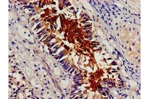 Immunohistochemistry of paraffin-embedded human lung tissue using ABIN7145766 at dilution of 1:100