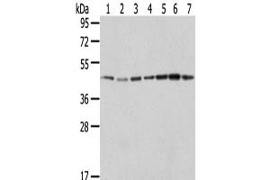Western Blot analysis of Raji, A549, Hela, HepG2, 231, K562 and A431 cells using ERP44 Polyclonal Antibody at dilution of 1/200 (ERP44 anticorps)