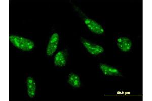 Immunofluorescence of purified MaxPab antibody to SNIP1 on HeLa cell. (SNIP1 anticorps  (AA 1-396))