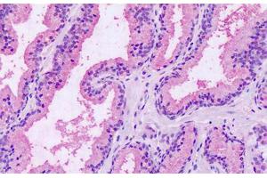 Anti-GPRC5A / RAI3 antibody IHC staining of human prostate. (GPRC5A anticorps  (Extracellular Domain))