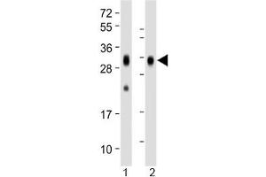 Western blot testing of human 1) spleen and 2) placenta lysate with Folate Receptor beta antibody at 1:1000. (FOLR2 anticorps)