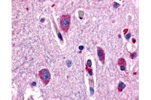 Anti-CHRM2 antibody IHC of human brain, neurons and glia. (Muscarinic Acetylcholine Receptor M2 anticorps  (Cytoplasmic Domain))