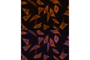 Immunofluorescence analysis of L929 cells using MRPL34 antibody (ABIN7268568) at dilution of 1:100.