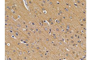 ABIN7094210 and ABIN7098256 at 1/100 staining rat brain tissue by IHC-P. (EXOSC10 anticorps  (Internal Region))