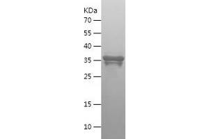 Western Blotting (WB) image for Integrin beta 1 (ITGB1) (AA 76-206) protein (His-IF2DI Tag) (ABIN7123470) (ITGB1 Protein (AA 76-206) (His-IF2DI Tag))