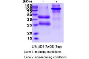 SDS-PAGE (SDS) image for Interleukin 12 (IL12) (Active) protein (His tag) (ABIN5853918)
