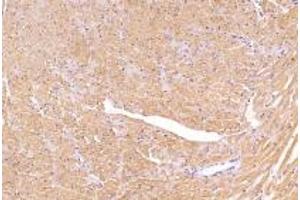 Immunohistochemistry analysis of paraffin-embedded mouse heart using,PSKH1 (ABIN7075291) at dilution of 1: 2800