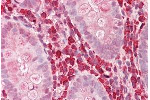 Image no. 2 for anti-Chitinase 3-Like 1 (Cartilage Glycoprotein-39) (CHI3L1) (AA 198-247) antibody (ABIN1493867)